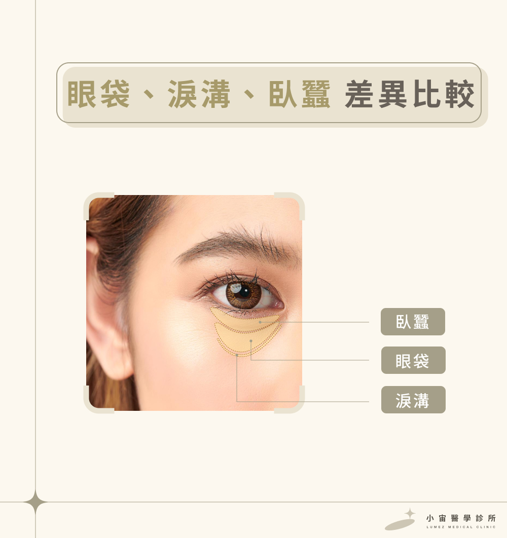 眼袋、淚溝、臥蠶差異比較