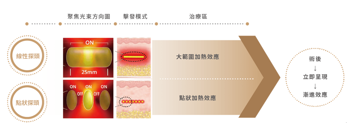 Q+音波拉提