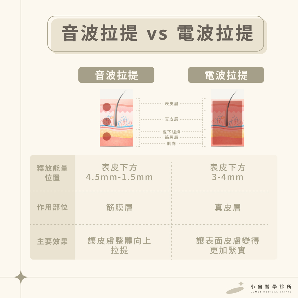 音波拉提與電波拉提的不同之處 